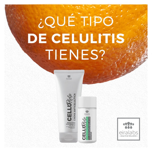 ¿Qué tipo de celulitis tienes? Pocas mujeres se libran