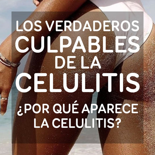 Los verdaderos culpables de la celulitis ¿Por qué aparece?